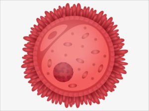 Συνδρομο Πολυκυστικών Ωοθηκών: Αντιμετωπίστε τα αίτια