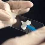ΔΗΜΗΤΡΑΚΟΠΟΥΛΟΣ ΓΥΝΑΙΚΟΛΟΓΟΣ ΓΛΥΦΑΔΑ ΤΕΣΤ ΠΑΠ ΥΠΟΓΟΝΙΜΟΤΗΤΑ