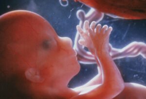 Δημητρακόπουλος Γυναικολόγος Γλυφάδα – Υπογονιμότητα – Αντιμετωπίστε τα αίτια: Βελτιώστε την ποιότητα των ωαρίων σας και αυξήστε τις πιθανότητες για εγκυμοσύνη χωρίς επιπλοκές