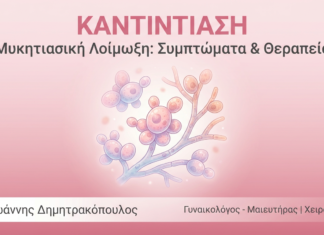 Καντιντίαση (Μυκητίαση): Συμπτώματα, Θεραπεία & Πρόληψη