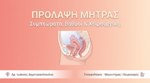 Πρόλαψη Μήτρας: Συμπτώματα & Χειρουργική Αντιμετώπιση