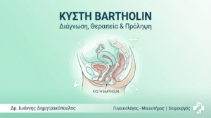 Κύστη Bartholin: Διάγνωση & Θεραπεία
