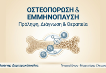 Οστεοπόρωση & Εμμηνόπαυση: Πρόληψη & Θεραπεία