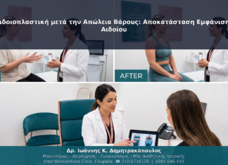 Αιδοιοπλαστική μετά την Απώλεια Βάρους: Αποκατάσταση Εμφάνισης Αιδοίου