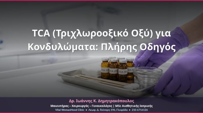 TCA (Τριχλωροοξικό Οξύ) για Κονδυλώματα: Πλήρης Οδηγός TCA (Τριχλωροοξικό Οξύ) για Κονδυλώματα: Πλήρης Οδηγός