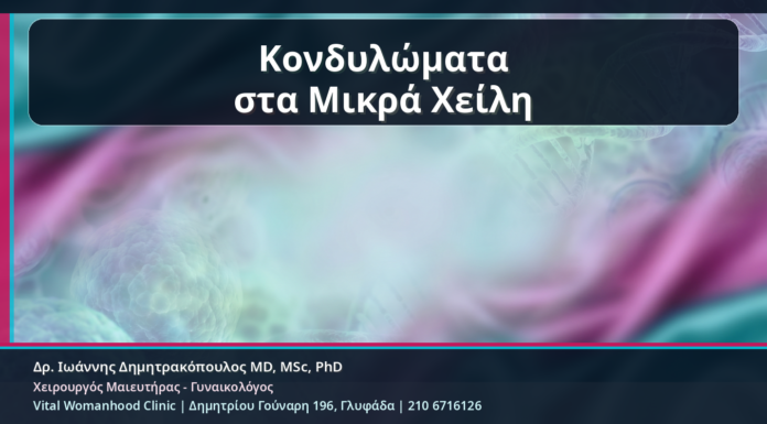 Κονδυλώματα στα Μικρά Χείλη: Αναγνώριση, Θεραπεία και Επούλωση χωρίς Υπερθεραπεία Κονδυλώματα στα Μικρά Χείλη - Κονδυλώματα στα Μικρά Χείλη: Αναγνώριση, Θεραπεία και Επούλωση χωρίς Υπερθεραπεία | Δρ. Ιωάννης Δημητρακόπουλος
