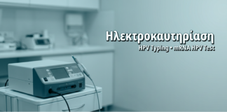 Ηλεκτροκαυτηρίαση Κονδυλωμάτων: Παραδοσιακή Τεχνική με Σύγχρονες Ενδείξεις