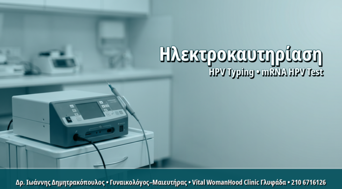 Γυναικολόγος Γλυφάδα: Ηλεκτροκαυτηρίαση Κονδυλωμάτων: Παραδοσιακή Τεχνική με Σύγχρονες Ενδείξεις Ηλεκτροκαυτηρίαση Κονδυλωμάτων: Παραδοσιακή Τεχνική με Σύγχρονες Ενδείξεις