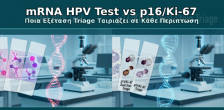 mRNA HPV Test vs p16/Ki-67 - Δρ. Ιωάννης Κ. Δημητρακόπουλος Γυναικολόγος Γλυφάδα