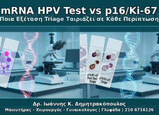 mRNA HPV Test vs p16/Ki-67: Ποια Εξέταση Triage Ταιριάζει σε Κάθε Περίπτωση mRNA HPV Test vs p16/Ki-67 - Δρ. Ιωάννης Κ. Δημητρακόπουλος Γυναικολόγος Γλυφάδα