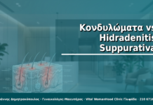 Κονδυλώματα vs Hidradenitis Suppurativa