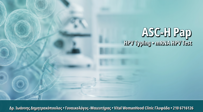 Γυναικολόγος Γλυφάδα: ASC-H στο Pap Test: Πώς Καθοδηγεί το HPV Typing και η Κολποσκόπηση ASC-H στο Pap Test: Πώς Καθοδηγεί το HPV Typing και η Κολποσκόπηση