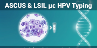 ASCUS & LSIL στο Pap Test: Πώς το HPV Typing Αλλάζει τη Διαχείριση