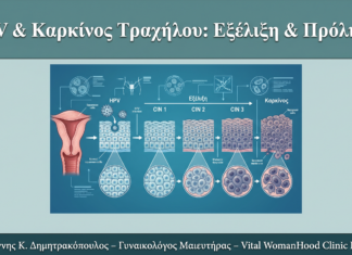 HPV και Καρκίνος Τραχήλου: Πώς Εξελίσσεται η Νόσος και Πώς να Προλάβετε