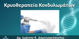 Κρυοθεραπεία Κονδυλωμάτων: Πώς Γίνεται με Υγρό Άζωτο