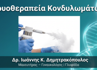 Κρυοθεραπεία Κονδυλωμάτων: Πώς Γίνεται με Υγρό Άζωτο