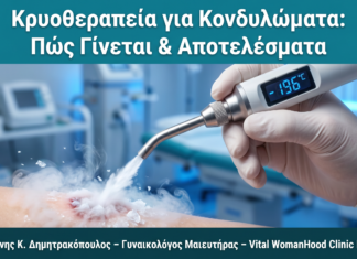 Κρυοθεραπεία για Κονδυλώματα: Τι Είναι, Πώς Γίνεται και Πόσες Συνεδρίες Χρειάζονται