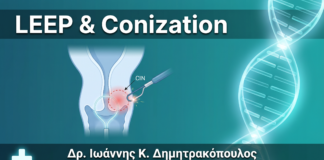 LEEP & Conization: Πώς Γίνεται η Αφαίρεση Προκαρκινικών Αλλοιώσεων Τραχήλου