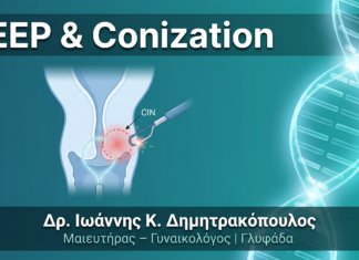 LEEP & Conization: Πώς Γίνεται η Αφαίρεση Προκαρκινικών Αλλοιώσεων Τραχήλου