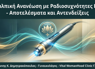 Κολπική Ανανέωση με Ραδιοσυχνότητες (RF): Αποτελέσματα και Αντενδείξεις
