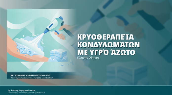 Κρυοθεραπεία Κονδυλωμάτων με Υγρό Άζωτο: Πλήρης Οδηγός