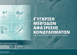 Σύγκριση Μεθόδων Αφαίρεσης Κονδυλωμάτων: Laser, Κρυοθεραπεία, Κρέμα, Χειρουργική