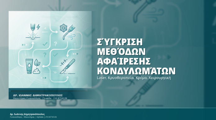 Σύγκριση Μεθόδων Αφαίρεσης Κονδυλωμάτων: Laser, Κρυοθεραπεία, Κρέμα, Χειρουργική