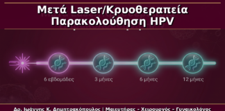 Μετά το Laser/Κρυοθεραπεία για Κονδυλώματα: Παρακολούθηση με HPV DNA, HPV Typing και mRNA Test