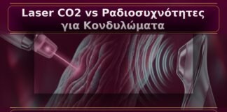 Κονδυλώματα: Laser CO2 vs Ραδιοσυχνότητες – Πρακτική Σύγκριση για τον Ασθενή