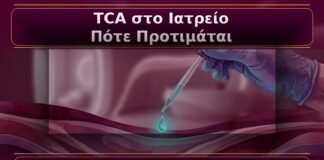 Κονδυλώματα και TCA στο Ιατρείο: Πότε Προτιμάται και Πώς Γίνεται