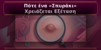 Κονδυλώματα: Πότε ένα «Σπυράκι» Χρειάζεται Άμεση Εξέταση από Γυναικολόγο