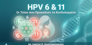 HPV 6 11 Κονδυλώματα - Δρ. Ιωάννης Δημητρακόπουλος Γλυφάδα