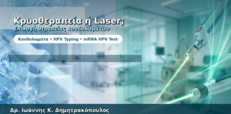 Κρυοθεραπεία ή Laser για Κονδυλώματα — Πώς Επιλέγεται η Μέθοδος