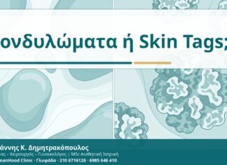 Μικρά κονδυλώματα ή θηλώματα δέρματος; Διαφορές και ασφαλής διάγνωση Κονδυλώματα ή Skin Tags; - Δρ. Ιωάννης Κ. Δημητρακόπουλος