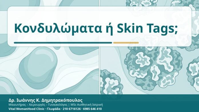 Κονδυλώματα ή Skin Tags; - Δρ. Ιωάννης Κ. Δημητρακόπουλος