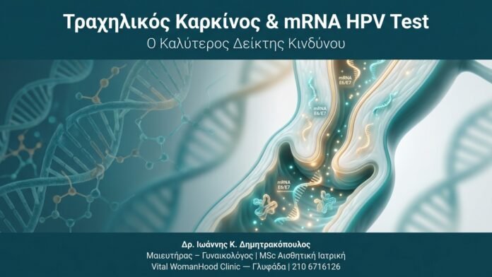 Τραχηλικός Καρκίνος & mRNA HPV Test — Ο Καλύτερος Δείκτης Κινδύνου Τραχηλικός Καρκίνος & mRNA HPV Test — Ο Καλύτερος Δείκτης Κινδύνου