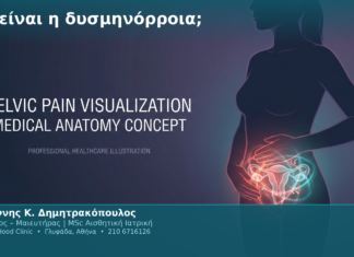 Τι είναι η δυσμηνόρροια; Τι είναι η δυσμηνόρροια;