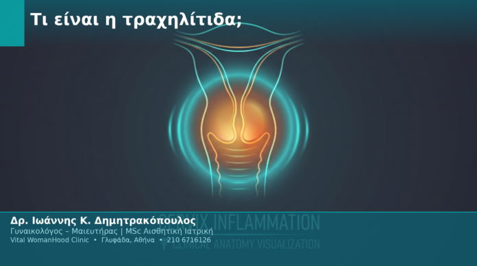 Τι είναι η τραχηλίτιδα; Τι είναι η τραχηλίτιδα;