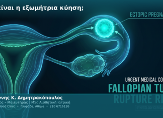 Τι είναι η εξωμήτρια κύηση; Τι είναι η εξωμήτρια κύηση;