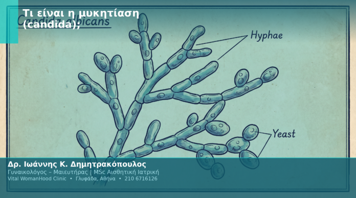 Τι είναι η μυκητίαση (candida); Τι είναι η μυκητίαση (candida);