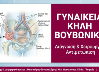 Γυναικεία Κήλη Βουβωνική: Διάγνωση & Χειρουργική