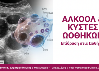 Αλκοόλ & Κύστες Ωοθηκών: Επίδραση στις Ωοθήκες