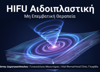 HIFU Αιδοιπλαστική: Βαθιά Σύσφιξη με Υπέρηχο — Αποτελέσματα 24 Μήνες