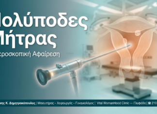Πολύποδες Μήτρας — Γλυφάδα | Δρ. Δημητρακόπουλος