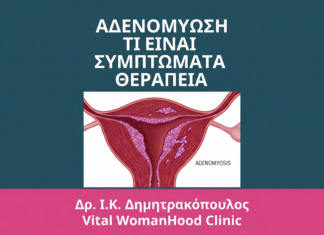 Αδενομύωση: Τι Είναι, Συμπτώματα & Θεραπεία