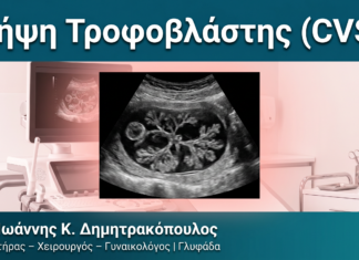 Λήψη Τροφοβλάστης (CVS) Λήψη Τροφοβλάστης (CVS) — Δρ. Δημητρακόπουλος Γλυφάδα