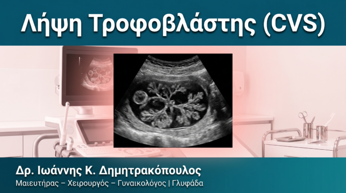 Λήψη Τροφοβλάστης (CVS) Λήψη Τροφοβλάστης (CVS) — Δρ. Δημητρακόπουλος Γλυφάδα