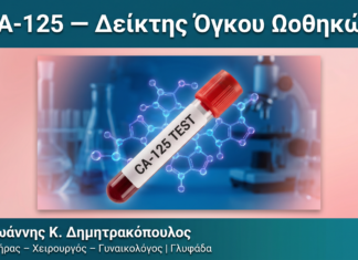 CA-125 — Δείκτης Όγκου Ωοθηκών CA-125 — Δείκτης Όγκου Ωοθηκών — Δρ. Δημητρακόπουλος Γλυφάδα