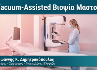 Vacuum-Assisted Βιοψία Μαστού Vacuum-Assisted Βιοψία Μαστού — Δρ. Δημητρακόπουλος Γλυφάδα