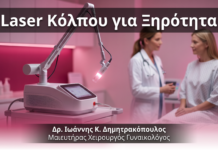 Laser Κόλπου για Ξηρότητα — FAQ | Γλυφάδα